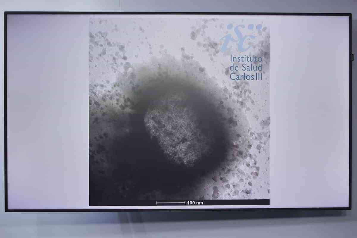 Se confirma como negativo el cuarto caso sospechoso de viruela del mono en Castilla-La Mancha