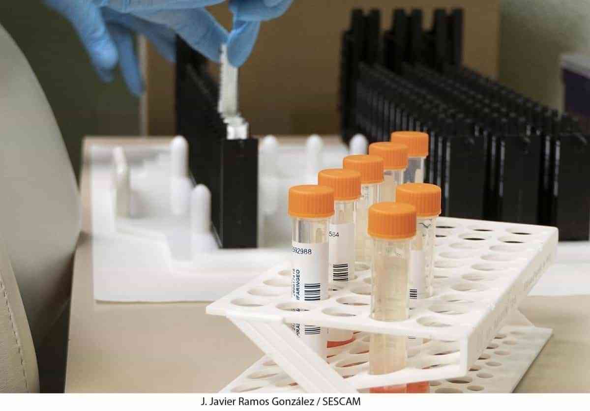 Los casos de viruela del mono en C-LM ascienden a 12 tras registrarse uno nuevo en la provincia de Guadalajara