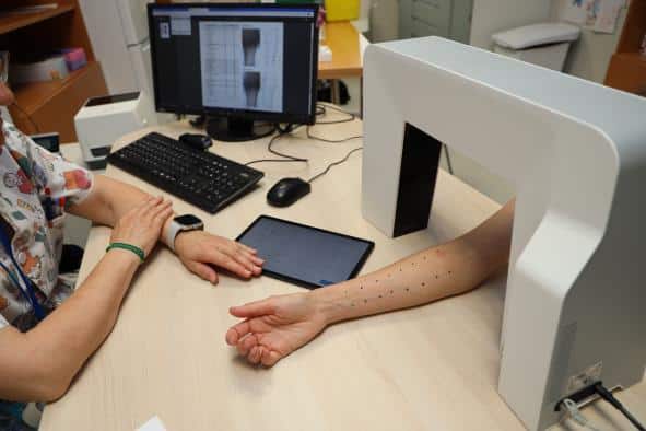 El Hospital Universitario de Toledo lanza una innovadora herramienta digital para la evaluación de pruebas cutáneas en Alergología.